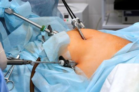 General Surgery